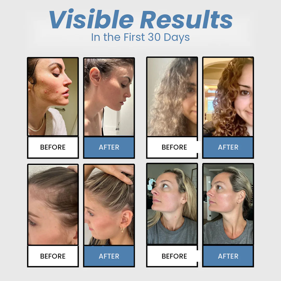Rainelle™ Filtered Shower Head — Hard Water Filter for Softer Skin & Healthier Hair