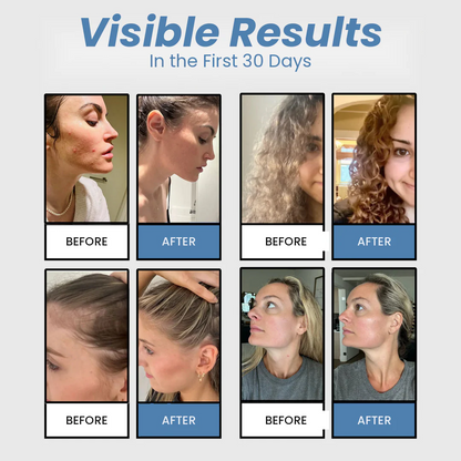Rainelle™ Filtered Shower Head — Hard Water Filter for Softer Skin & Healthier Hair